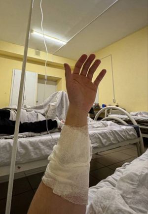 Боксёр из Ярославля попал в реанимацию после пачки суперострых чипсов с перцем