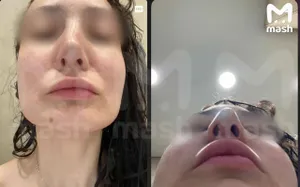 Больше десяти пациенток изуродовали в элитной клинике в Томске