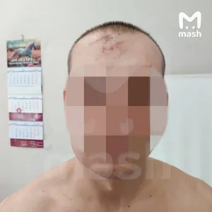 Агрессивного интернет-комментатора нашли и избили ветками в Москве