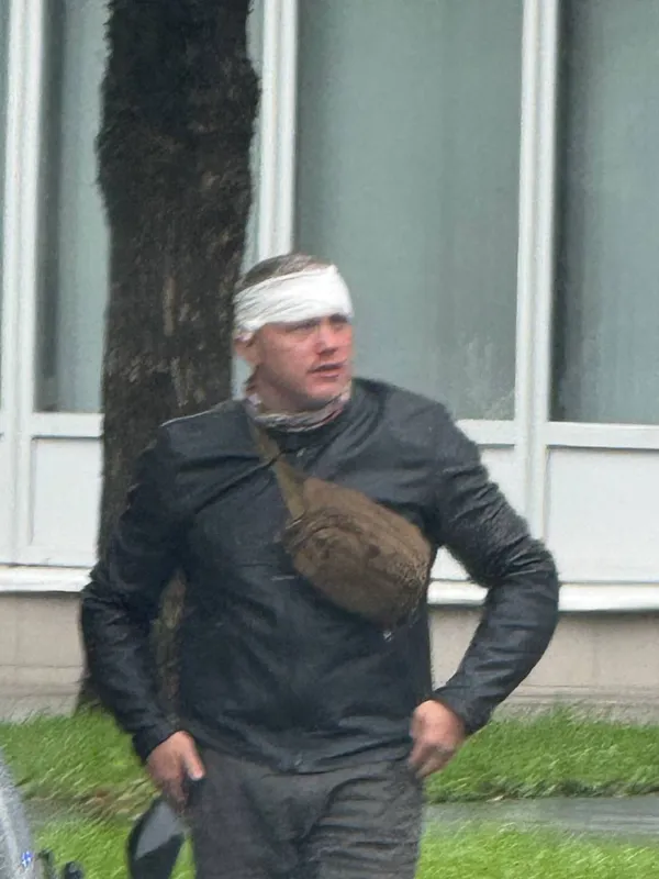 Мужу Елены Блиновской разбили голову и нос