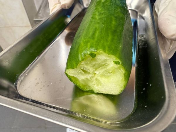 Секс-игры в Уфе закончились походом к врачу — из девушки пришлось доставать огурец