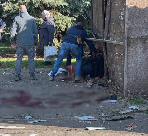 Житель Луганска пнул заминированную музыкальную колонку, мужчине оторвало ногу