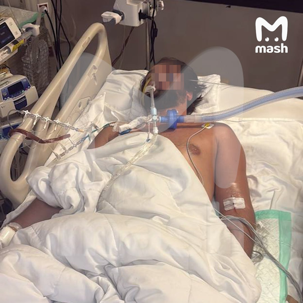 Стала известна причина смерти российского туриста на Бали