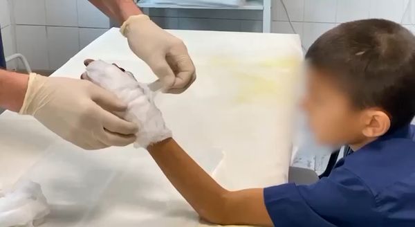 Иркутские хирурги пришили школьнику отрубленный палец