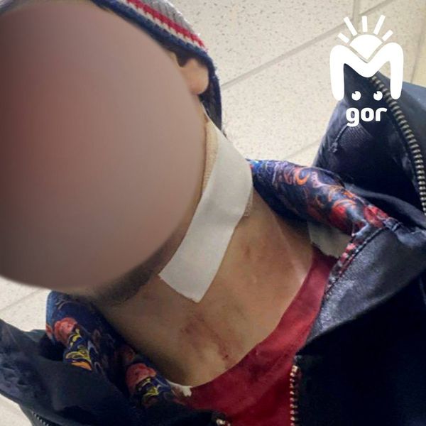 На сторожа, который ударил ножом ученика в школе Дербента, завели уголовное дело