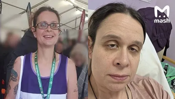 Британку парализовало после серии МРТ головного мозга