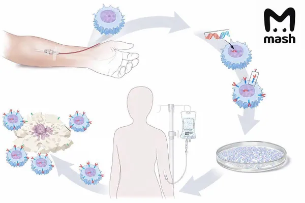 Инновационный метод борьбы с раком крови появится в четырёх московских стационарах