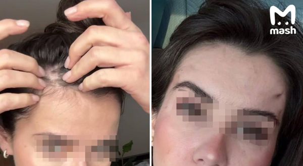 Хирурга элитной пластической клиники в Москве обвинили в домогательствах после неудачной процедуры