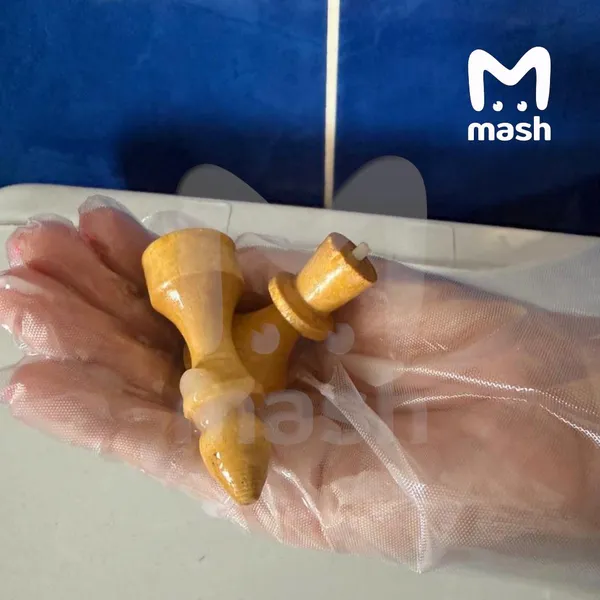 Жителя Уфы госпитализировали с двумя шахматными фигурами в прямой кишке