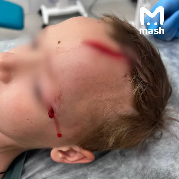 На внука писательницы Дарьи Донцовой напала собака у его дома в Подмосковье