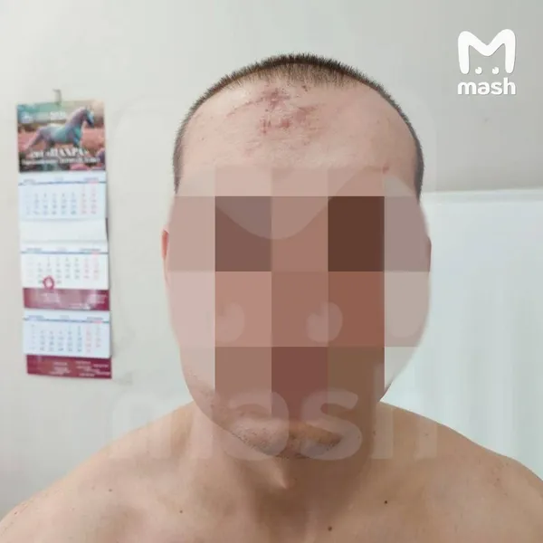 Агрессивного интернет-комментатора нашли и избили ветками в Москве
