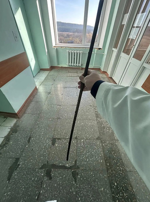 Подросток в Кировской области во время паркура упал на арматуру, штырь чуть не проткнул ему сердце