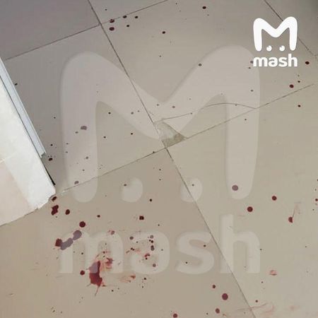 Буйный пациент-алкоголик напал на сотрудников больницы под Тулой — его застрелили при задержании