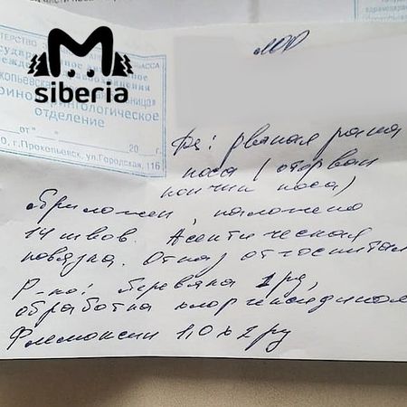 Мужчина из Прокопьевска откусил нос незнакомой женщине