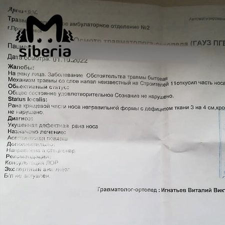 Мужчина из Прокопьевска откусил нос незнакомой женщине