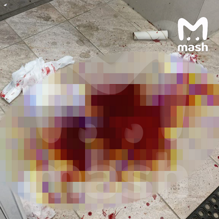 Жителю подмосковной Электростали сняли скальп за зелёный ирокез