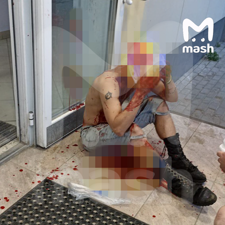 Жителю подмосковной Электростали сняли скальп за зелёный ирокез