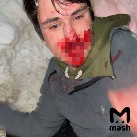 Полиция Белгорода разыскивает банду нападавших на местных жителей