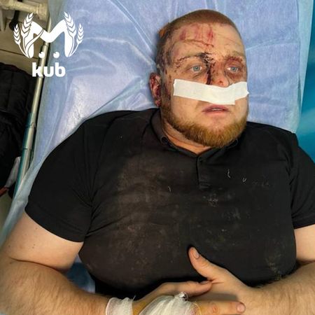 Двоих полицейских серьёзно ранили на Стахановской