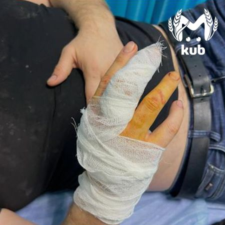 Двоих полицейских серьёзно ранили на Стахановской