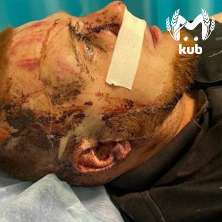 Двоих полицейских серьёзно ранили на Стахановской