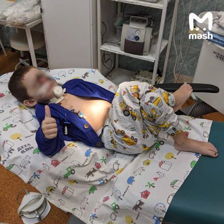 Краснодарские хирурги без трансплантации восстановили лицо мальчика, которое оторвала собака