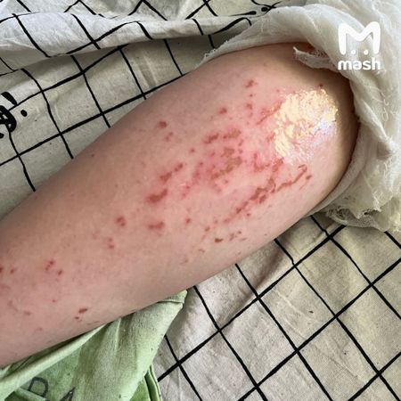 В подмосковном Щелково разыскивают кислотного маньяка