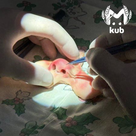 Краснодарские хирурги провели уникальную операцию мальчику, чье лицо откусила собака в Карачаево-Черкесии