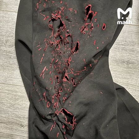 В подмосковном Щелково разыскивают кислотного маньяка