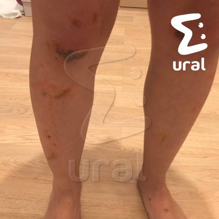 На девушку в Екатеринбурге напал неизвестный и пытался изнасиловать