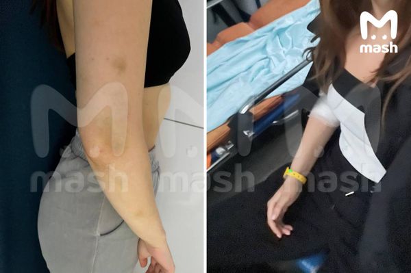 В Москве бойца Hardcore Fighting Джабраила Алиева обвинила в избиении его девушка