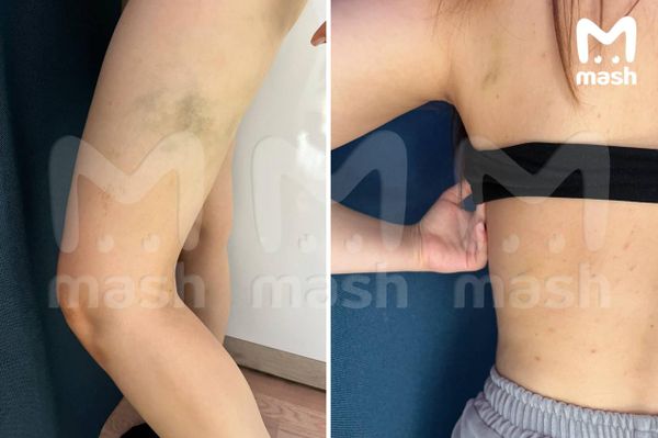 В Москве бойца Hardcore Fighting Джабраила Алиева обвинила в избиении его девушка