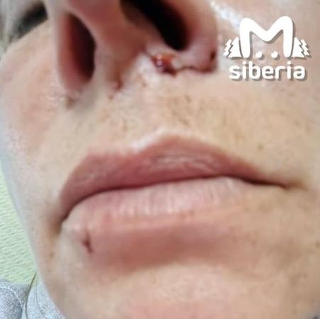 Хаски, сбежавшие из кемеровского парка, покусали женщину и загрызли её собачку