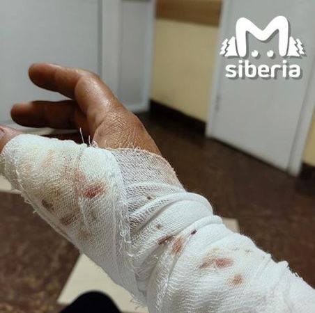 Хаски, сбежавшие из кемеровского парка, покусали женщину и загрызли её собачку