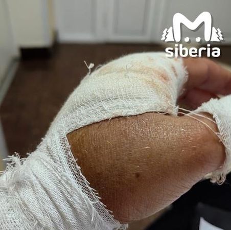 Хаски, сбежавшие из кемеровского парка, покусали женщину и загрызли её собачку
