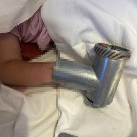 Полуторагодовалая девочка засунула руку в мясорубку в Баймаке