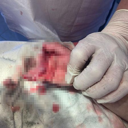 Полуторагодовалая девочка засунула руку в мясорубку в Баймаке