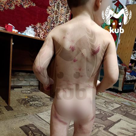 В Тимашевске многодетная мать избивает 3-летнего сына