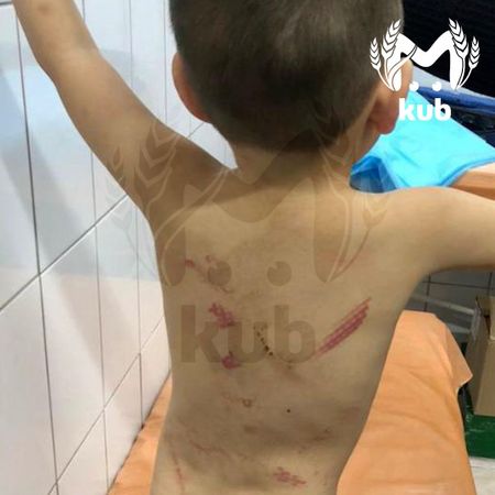 В Тимашевске многодетная мать избивает 3-летнего сына