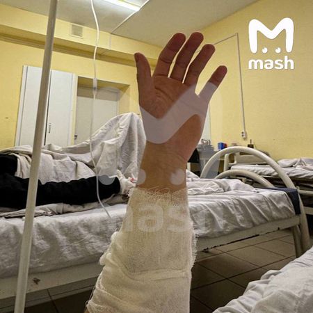 Боксёр из Ярославля попал в реанимацию после пачки суперострых чипсов с перцем