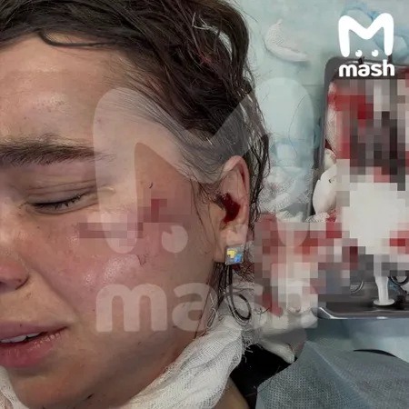 Победительницу конкурсов красоты избили и изуродовали после концерта группы "Тату" в Казани