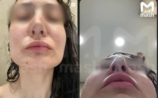 Больше десяти пациенток изуродовали в элитной клинике в Томске