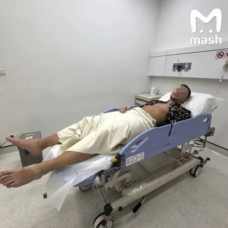 Туриста из России на отдыхе атаковала креветка-богомол — у мужчины сильный ушиб ноги