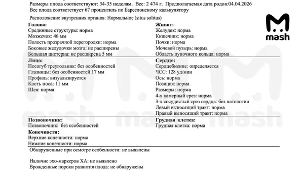 У женщины из Казани родился ребёнок с врождёнными патологиями позвоночника и рёбер