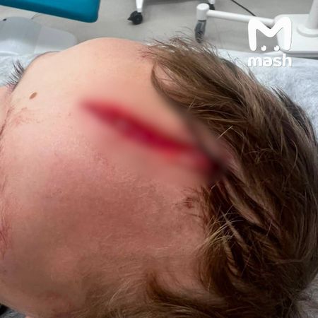 На внука писательницы Дарьи Донцовой напала собака у его дома в Подмосковье
