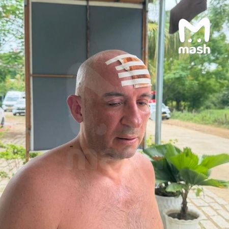 Россиянина бросили с пробитой головой после ЧП на экстрим-экскурсии во Вьетнаме
