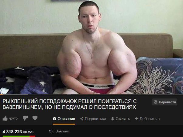 Хирурги рассказали об операции Кирилла Терешина. И вот что: