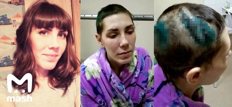 Житель Иркутской области вывез бывшую в лес, избил битой, ударил три раза ножом и оставил умирать. Он остался на свободе.
