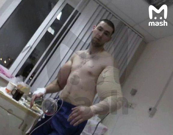 Кириллу Терешину не смогли выкачать весь синтол из рук-базук.