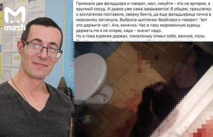 СК проверяет смерть журналиста, которому останавливали кровотечение курицей